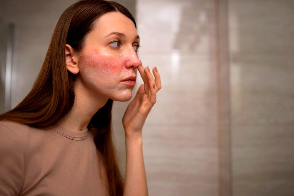 Jeune femme constate la rougeur au visage